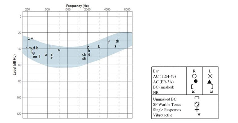 Basic Hearing Evaluation
