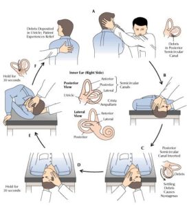 Vestibular Rehabilitation Program