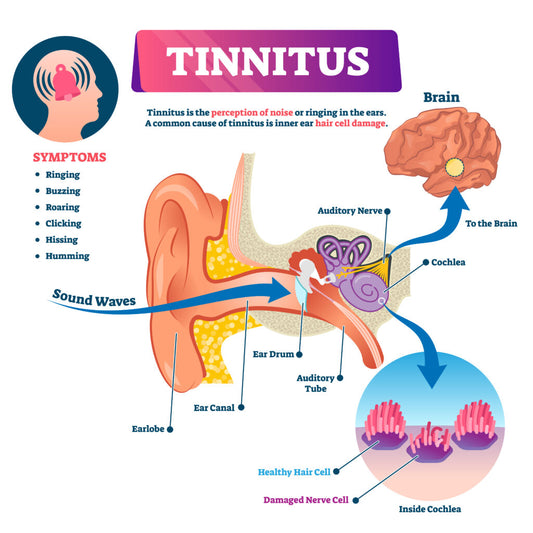 Tinnitus Evaluation